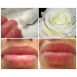 Честные отзывы о Аевит гель для губ