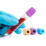 Честные отзывы о ЭПР ТСА тест