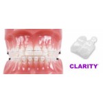 Честные отзывы о Брекеты Clarity Advanced Flash Free