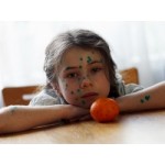 Честные отзывы о Ветряная оспа (ветрянка)