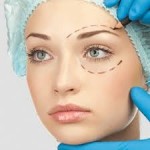 Честные отзывы о Блефаропластика