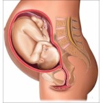 Честные отзывы о Беременность